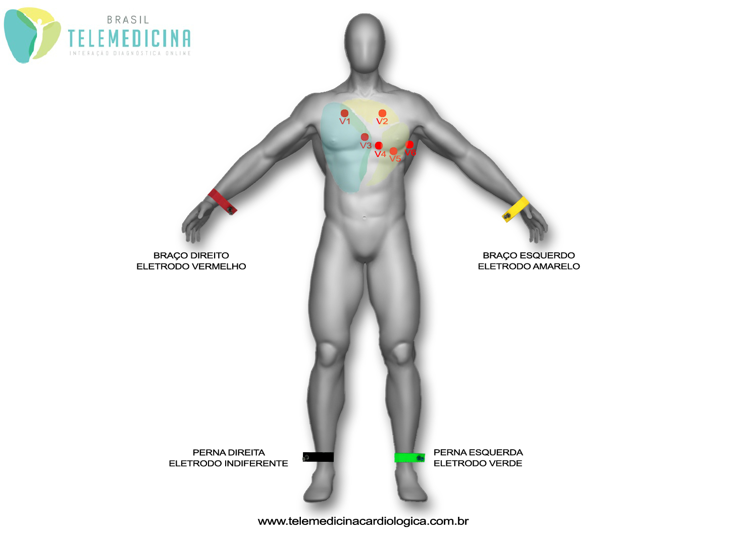 ECG-Eletrodos02 copia cópia